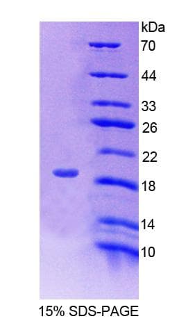 Human FKBP2 Protein (Recombinant His-T7)
