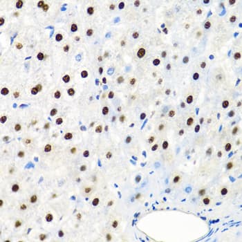 SSB / La Antibody