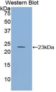 RGS4 Antibody (aa38-205)