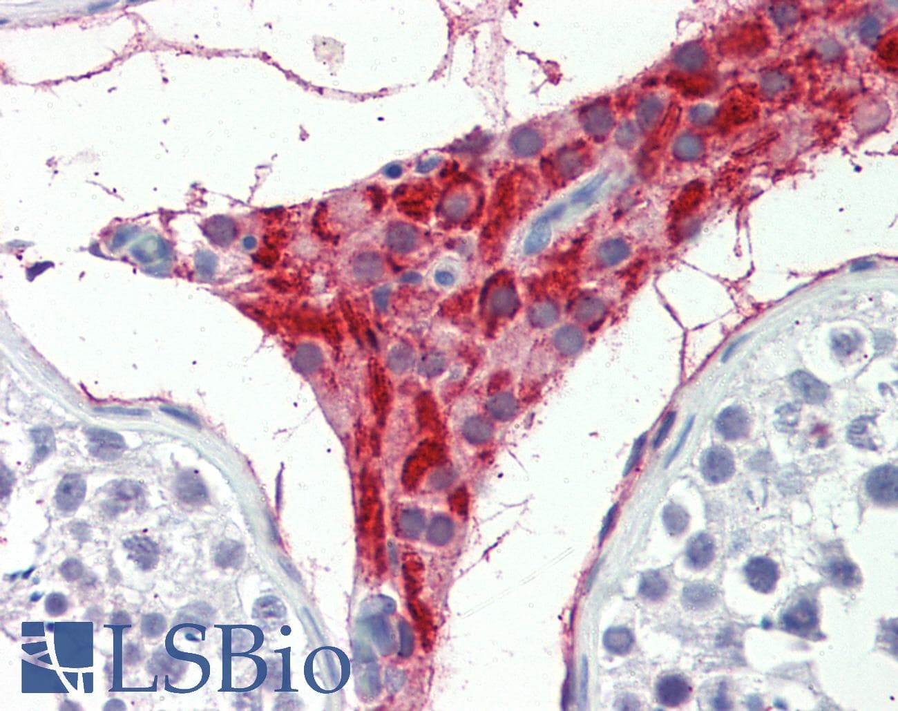 IHC-plus™ TIAM2 Antibody (aa9-19)