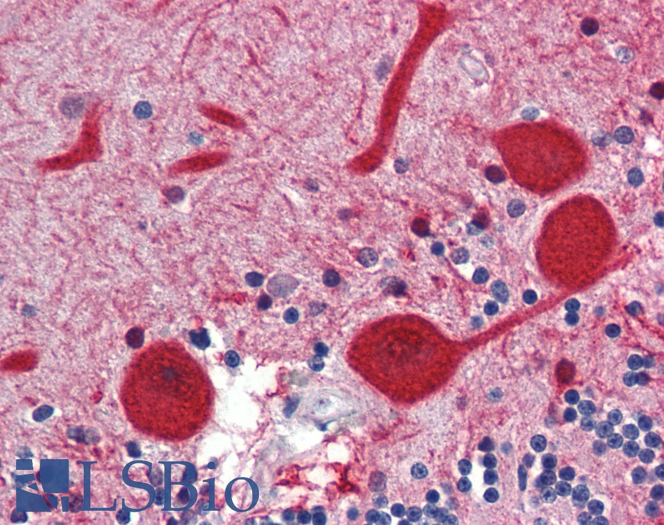 Polyclonal Rabbit anti-Human EMX2 Antibody (N-Terminus, IHC, WB)