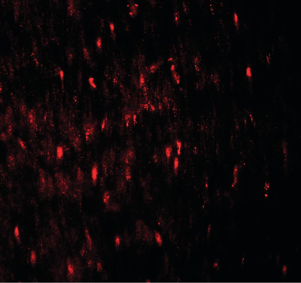 IHC-plus™ ATG18 / WIPI1 Antibody
