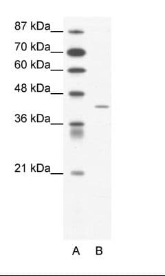 Polyclonal Rabbit anti-Human SSTR4 Antibody (aa163-212, WB)