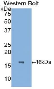 TTR / Transthyretin Antibody (aa21-150)