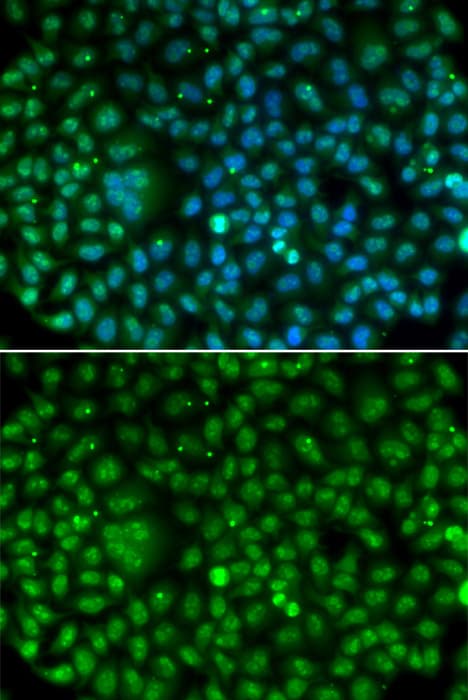 MKI67 / Ki67 Antibody