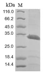 Human MCNAA / BPHL Protein (Recombinant 10His, N-terminus + Myc, C-terminus)