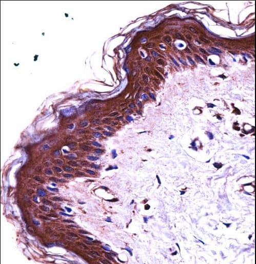 S100A7 / Psoriasin Antibody (aa2-31)