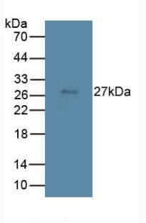 TMEM27 / Collectrin Antibody
