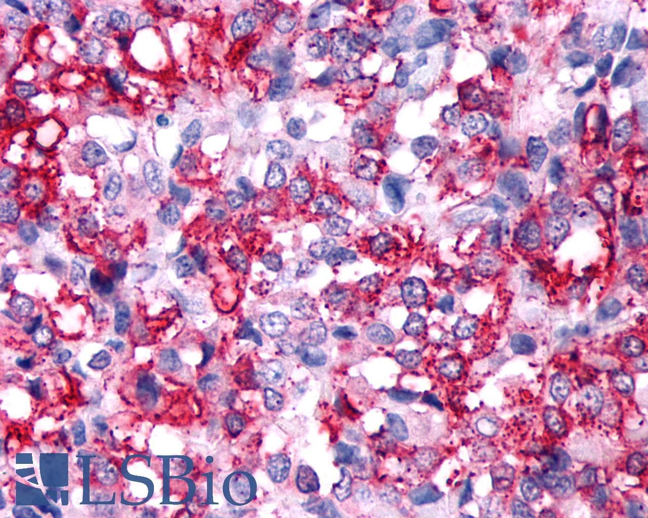 PathPlus™ Polyclonal Rabbit anti-Human RXFP2 / LGR8 Antibody (Cytoplasmic Domain, IHC, WB)