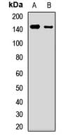 ULK1 Antibody