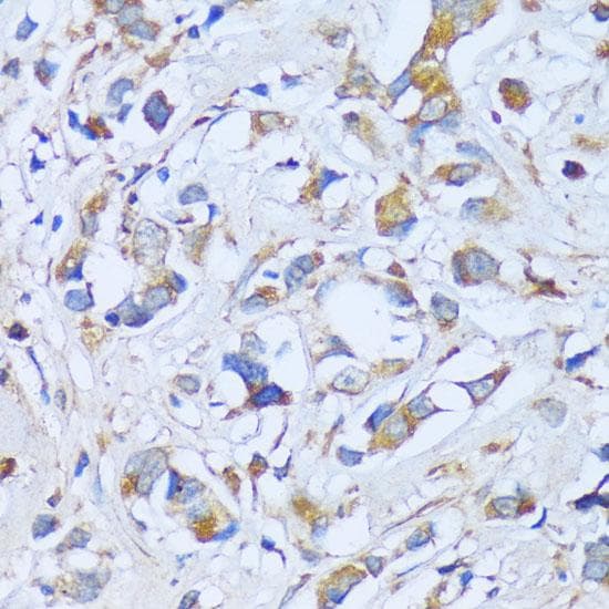 ACADSB Antibody