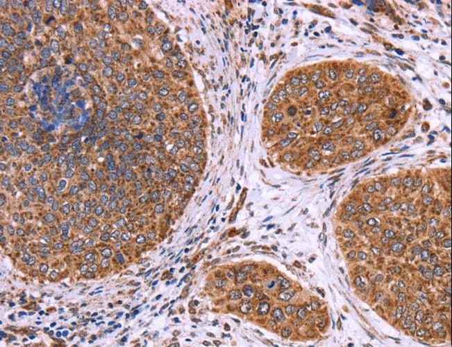 CLUAP1 Antibody