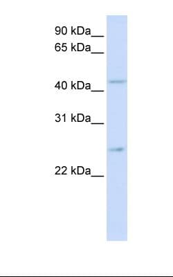 SLC37A4 / G6PT Antibody (aa38-87)