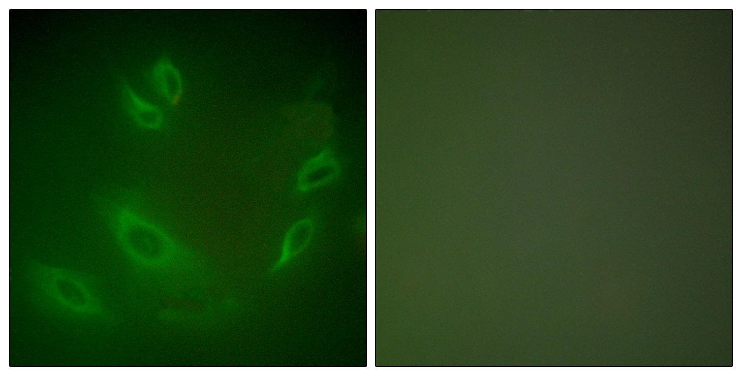 Polyclonal Rabbit anti-Human HSPH1 / HSP105 Antibody (IHC, IF, WB)