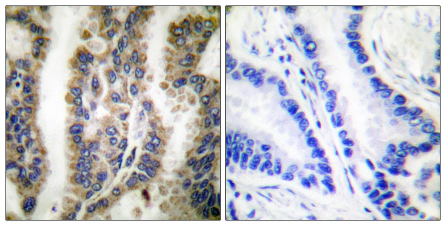 Polyclonal Rabbit anti-Human HSPD1 / HSP60 Antibody (IHC, IF, WB)
