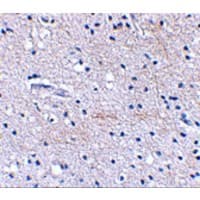 FBXL20 Antibody