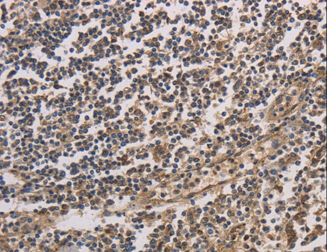 Polyclonal Rabbit anti-Human HSF1 Antibody (IHC)
