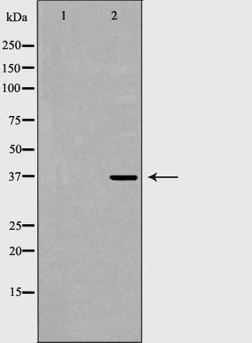 FBP1 Antibody