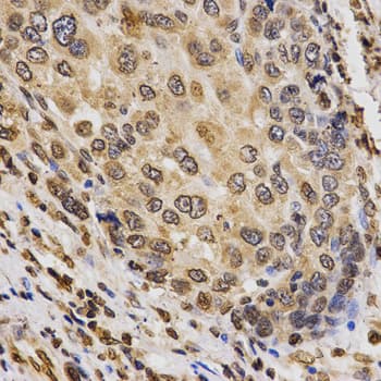 Histone H3 Antibody (Tri-Methyl-Lys9)