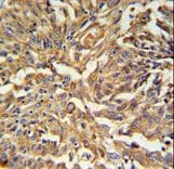 KRT19 / CK19 / Cytokeratin 19 Antibody (aa336-365)
