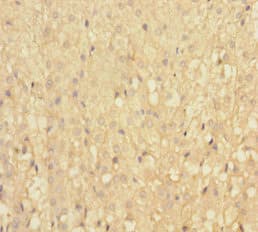 IFT22 / RABL5 Antibody (aa1-185)