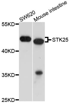 Polyclonal Rabbit anti-Human STK25 Antibody (WB)