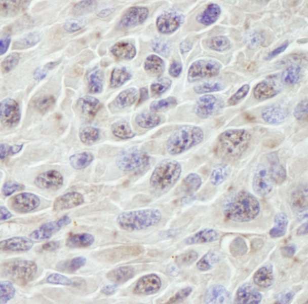 PRKRIR Antibody (aa150-200)