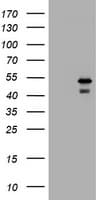 PARVB Antibody (clone OTI1B7)