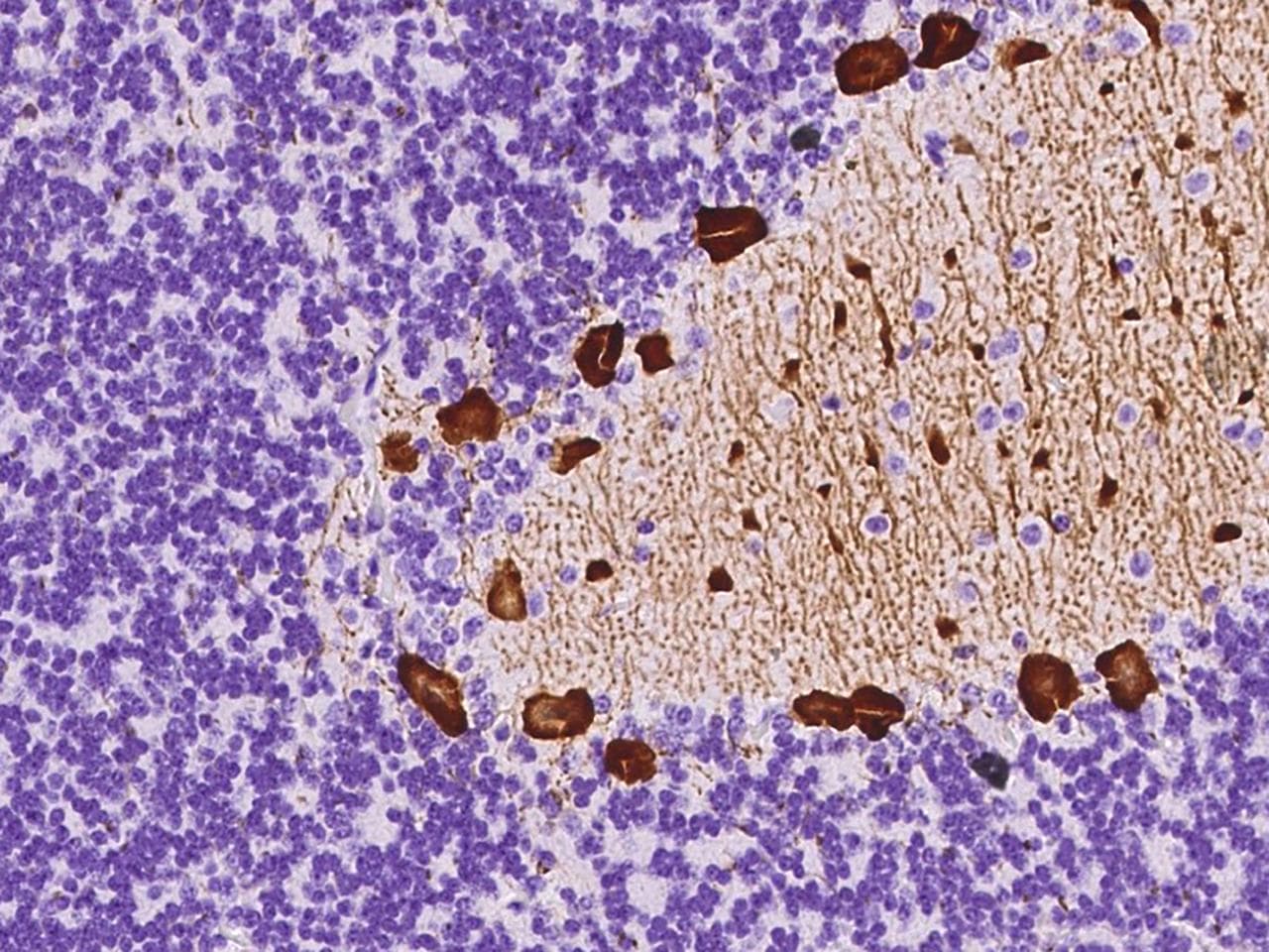 PPP1R17 / C7orf16 Antibody