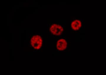 Polyclonal Rabbit anti-Human LIG4 / DNA Ligase IV Antibody (IHC, IF, WB)
