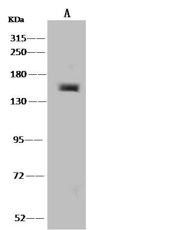 LIMCH1 Antibody