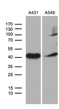 ELF3 / ESE1 Antibody (aa175-286, clone OTI4G5, Carrier-free)