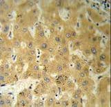 TTR / Transthyretin Antibody (aa71-98)