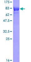 Human TOM1 Protein (Recombinant GST)