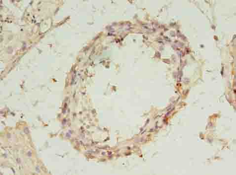 REXO4 / MPMC2 Antibody