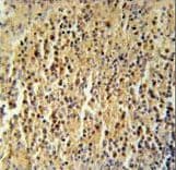 CCDC106 Antibody (aa151-180)