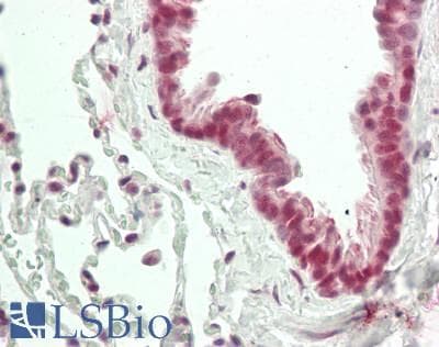IHC-plus™ MAGEA9 Antibody (N-Terminus)