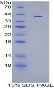 Rat IGF1 Protein (Recombinant His-GST)
