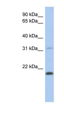 DCAL1 / CLECL1 Antibody (aa71-120)