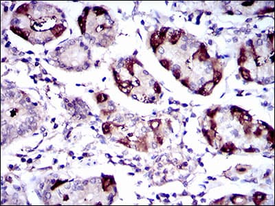 Monoclonal Mouse anti-Human SLC27A5 / BACS Antibody (clone 4B11C10, aa508-570, IHC, WB)