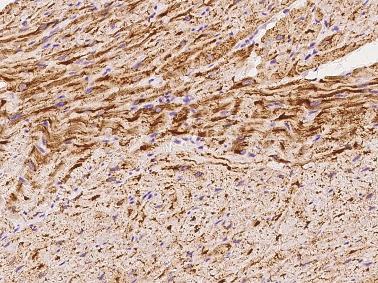 NDUFS2 Antibody