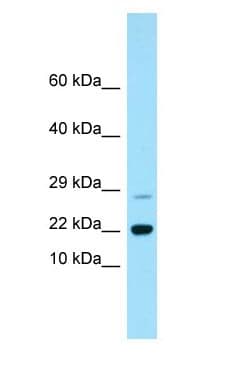 RAP2B Antibody (aa106-155)