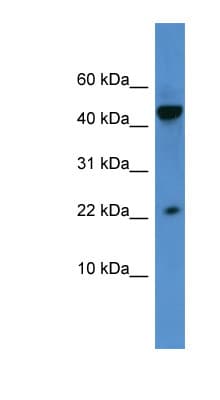 REG3A Antibody (aa43-92)