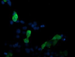 MAP2K3 / MEK3 / MKK3 Antibody (clone OTI5C9)