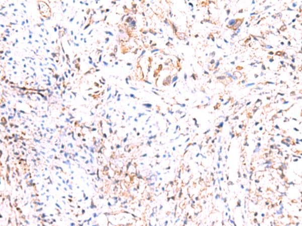 Polyclonal Rabbit anti-Human PHKG2 Antibody (IHC)