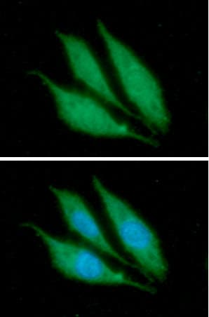 IHC-plus™ Monoclonal Mouse anti-Human KRT14 / CK14 / Cytokeratin 14 Antibody (clone AT13F4, IHC, IF, WB)
