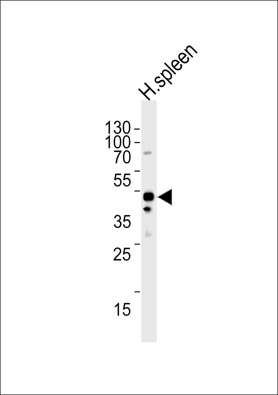 Polyclonal Rabbit anti-Human CHMP6 Antibody (aa1-30, WB)