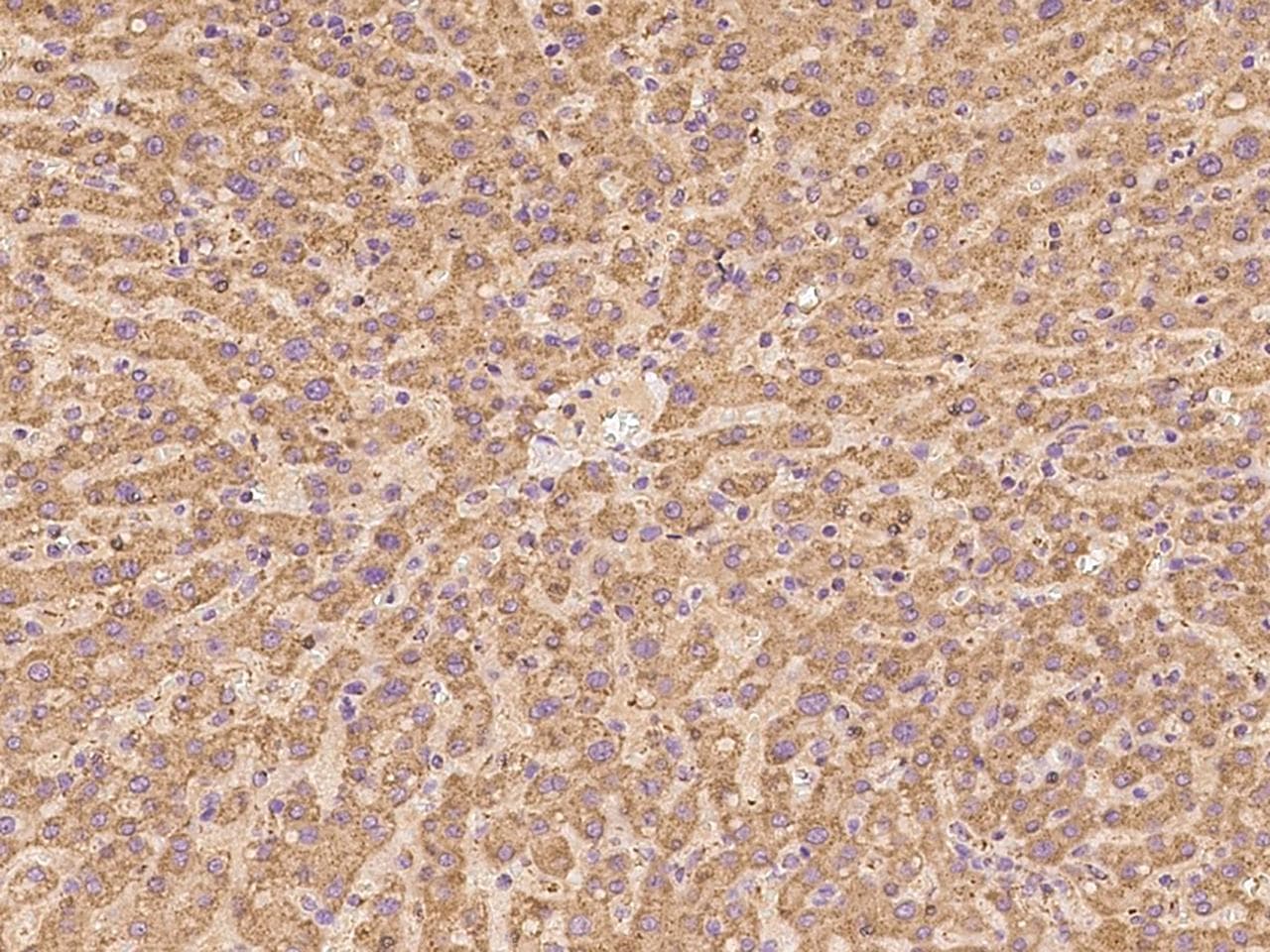 NDUFA13 / GRIM19 Antibody