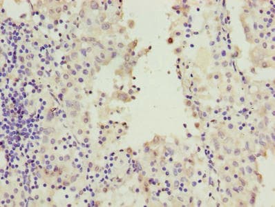 Polyclonal Rabbit anti-Human RAB20 Antibody (IHC, WB)
