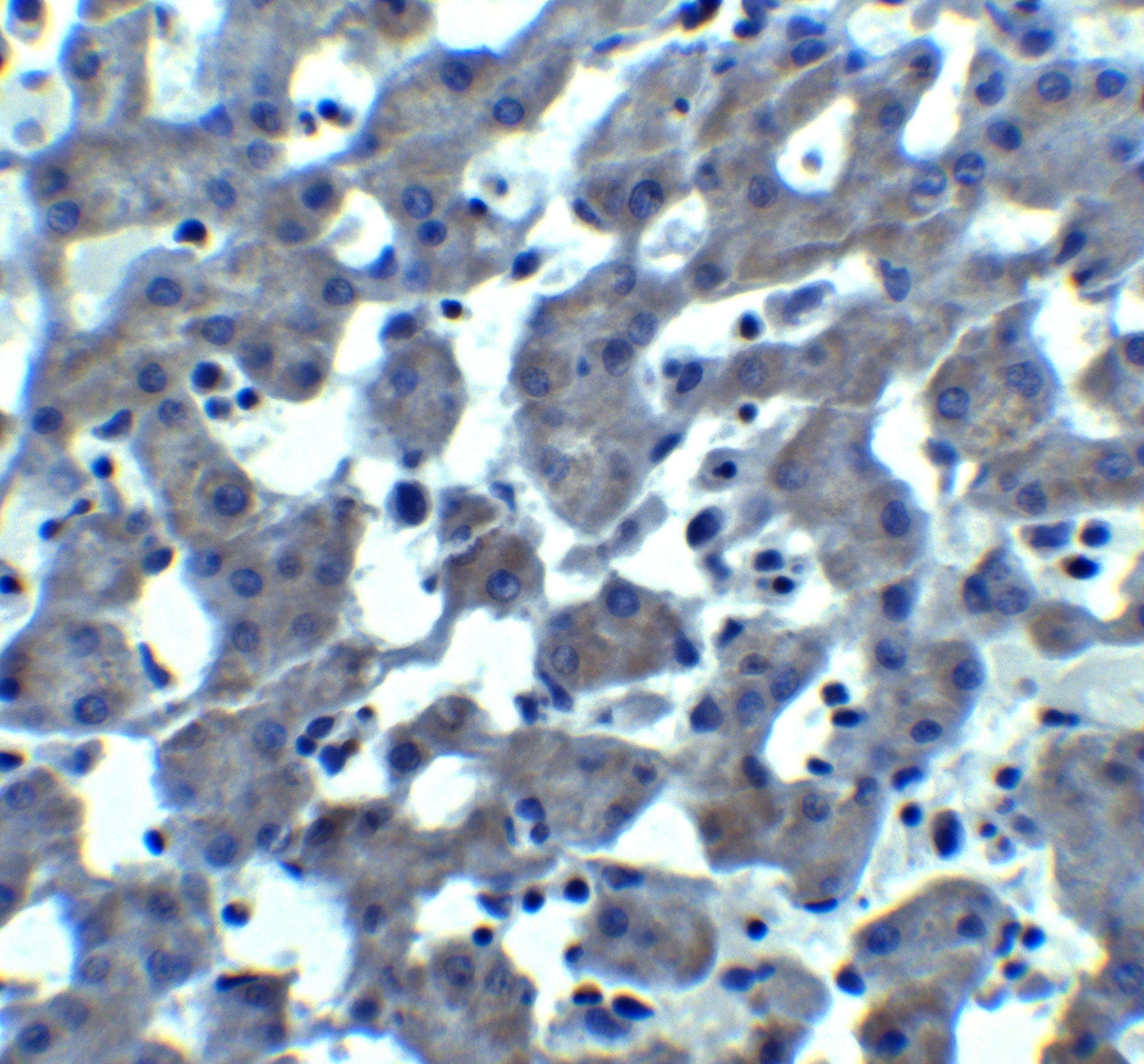 TRO / Trophonin Antibody